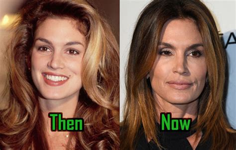 cindy crawford nose|Cindy Crawford’s Iconic Look: How Her Facial Features